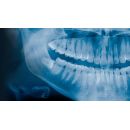 Befundmonitore fr Dental (Raumklasse 5, Befundarbeitsplatz)