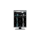 Eizo RadiForce RX370 - 3-Megapixel-LCD-Farbmonitor mit 5...