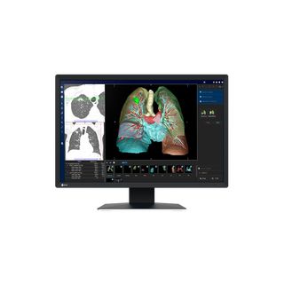 Eizo RadiForce MX243W - Fr den Einsatz mit radiologischen und mikroskopischen Bildern