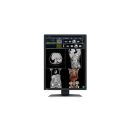 Eizo RadiForce RX270 - 2 MP Farbmonitor für die...