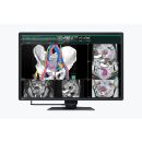 Eizo RadiForce RX660 - 30" 6 MP Befundungsmonitor...