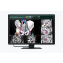 Eizo RadiForce RX660 - 30 6 MP Befundungsmonitor (Farbe)