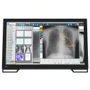 Eizo RadiForce MS236WT-A - 23"-DICOM-Preset-Monitor...