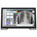 Eizo RadiForce MS236WT-A - 23-DICOM-Preset-Monitor mit...