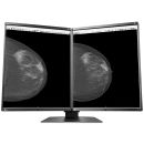 Eizo RadiForce GX560 MammoDuo Graustufen-Monitor mit 5 MP