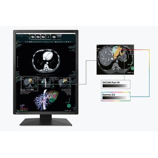 Eizo RadiForce MX217-SB - Monitor fr Dental-Befundungsrume und Schnittbilder (CT/MRT)