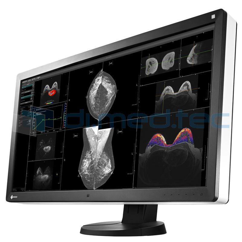 Mammographie-Screening Freigabe für den EIZO RadiForce RX850